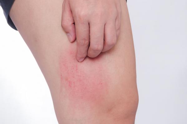 quitar los granitos de las piernas